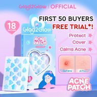 [ Free Trial for First 50 Members ] [NEW ON 14 August 6PM] Glad2Glow Decorative Acne Patch - Hologra