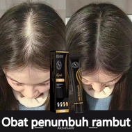 Newww Penumbuh Rambut Penumbuh Rambut Botak Serum Penumbuh Rambut Hair