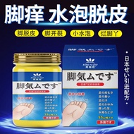 进口脚气膏止痒脱皮脚臭脚趾脚痒香港脚烂脚丫起泡重度抑菌膏正品 1瓶【高效】