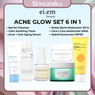 EIEM Beauty 6 in 1 Acne Skincare Package - cleanser | Toner | Serum | Moist | Copy sunscreen