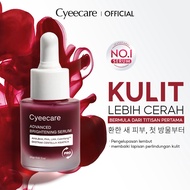 Cyeecare Advanced Peeling Serum AHA/BHA/PHA/LHA Fade Dark Spot & Acne Glowing Glass Skin (20g)