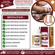 Obat Bengkak Pada Kaki Mengempeskan Pembengkakan Kaki Bengkak Karena Asam Urat Diabetes Jantung Ginjal Pergelangan Kaki Bengkak Nyeri Keseleo Tangan Bengkak Edema Perifer Telapak Kaki Tumit Sakit Jamu Herbal Alami Black Garlic Kapsul Bawang Hitam