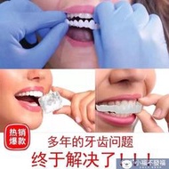 牙套吃飯神器仿真假牙套美白 矽膠 鍍膜門牙縫遮蓋蛀牙齙牙黃變白