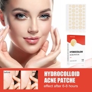 EELHOE Hydrogel Acne Patch Invisible Makeup Closed Acne Patch Cleansing Acne Waterproof Breathable A