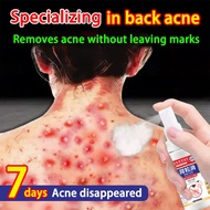 back acne spray body acne spray acne scar removal spray 60ml Anti-mite  relieve itching reduce acne 