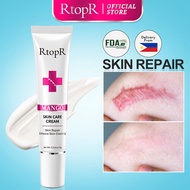 RtopR Scar Removal Cream Acne Scar Face Face Cream Skin Care Stretch Burn Scar Remover Skin Spots Bo