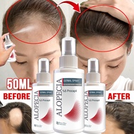serum rambut gugur Hair Growth Serum hair tonic growth hair gain pro Anti Hair Fall Fast Hair Growth