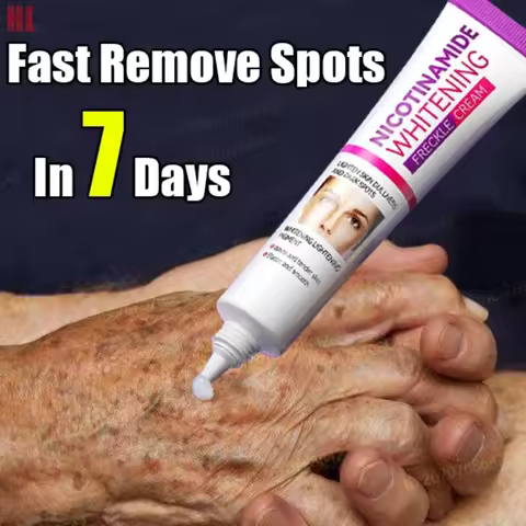 Mild Niacinamide Lightening Melasma Cream Effectively Fade Melanin Bleaching Cream Remove Dark Pigme