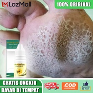 Obat kaki pecah2 kering parah kaki rayapan dan bau kaki flek kesemutan dan kebas - Propolis SM