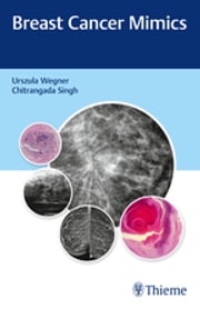 Breast Cancer Mimics Urszula Wegner