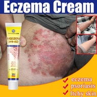 Psoriasis Cream antifungal cream eczema cream antiseptic cream cream gatal kulit krim gatal kulit he
