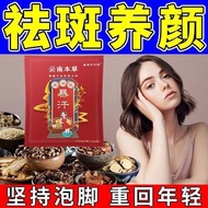 【祛斑真不難】艾草祛斑泡腳藥包美容養顏淡斑排毒祛濕去黑色素