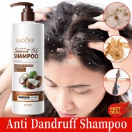 Coconut Shampoo Syampoo kelemumur ubat kepala scalp dandruff kepala psoriasis shampoo itchy scalp tr