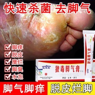 Athlete's foot medicine antibacterial antipruritic脚气药抑菌止痒脚臭脚气膏治脚汗臭脚汗脚烂脚丫药死皮膏去死皮q_gupqoidoq0uso_gl31o