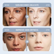 niacinamide brightening skincare melasma care bleaching skin whitening whitening Hand whitening skin