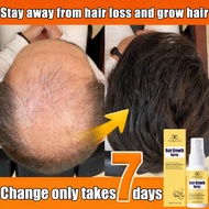 Hair growth serum hair tonic Growth Spray 30ml prevent hair loss quick hair growth