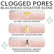 EELHOE blackhead removal tearing nasal Mask EELHOE blackhead removal tearing nasal Mask EELHOE black