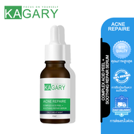 KAGARY Acne Recovery System เซ็ตเซรั่มโจมตีสิว + ครีมปลอบประโลมผิว