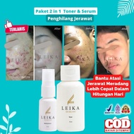 2in1 Serum & Toner Package acne Removal acne scar remover acne removal package to remove acne scars 