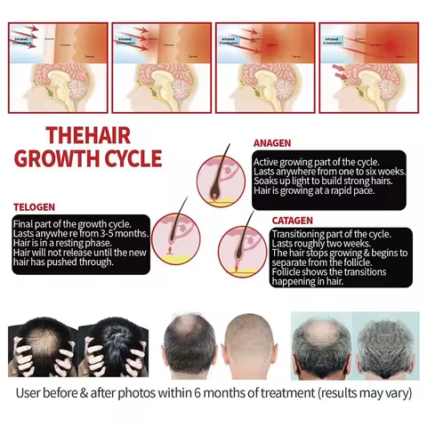 Infrared Liner 660nm 850nm Head Pain Relief Promoting Hair Regeneration Device Hair Loss Treatment C
