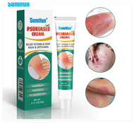 【JiuJiu】Psoriasis Cream Relief Eczema and Skin Rash and Urticaria  Remover Cream