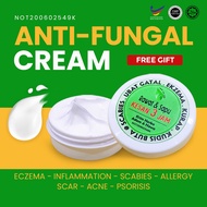 ubat gatal kulit, krim kurap dan gatal, gatal kurap, herbal cream, krim gatal kulit, eczema baby, ub