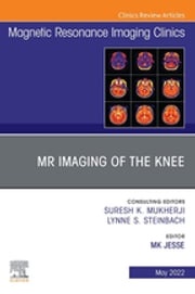 MR Imaging of The Knee, An Issue of Magnetic Resonance Imaging Clinics of North America, E-Book MK Jesse, MD