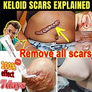 Scar Repair Cream Scar Removal  Pimple Scar Removal Cream scar removal cream Scar Silicone Gel for A