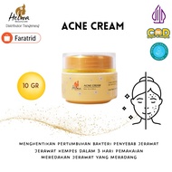 ACNE CREAM HELWA ACNE OINTMENT Acne Treatment Acne Spot Treatment
