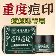 【香港大药房】青春痘熬夜上火痘姨妈痘快速祛痘印痘坑祛痘膏医用
