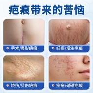 Scar Cream Silicone Scar Removal Cream Burn Burn Post-operative Cut Belly Production Stretch Mark Sc