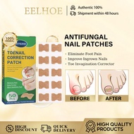 Jaysuing 50pcs Antifungal Nail Patches Ingrown Toenail Correction Strips Ingrown Toenail Treatment a