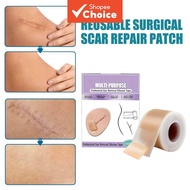 Silicone Scar Sheets 4×150cm Scar Tape For Surgical C-Section Keloid Tummy Tuck Scar Removal Repair