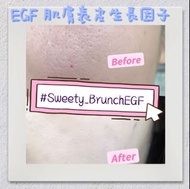 EGF 肌膚表皮生長因子