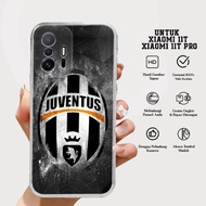XIAOMI 11T Case / 11T PRO - Latest Casing Miracle Case [MOTIF 50] Silicone - XIAOMI 11T Case / 11T P