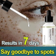 niacinamide serum dark spot serum whitening serum pigmentation serum melasma remover Effective Dark 