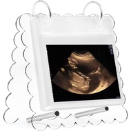 Flip Ultrasound Photo Album with Stand, Refillable Flip-Through Display for 3x4 Pictures, Acrylic Sc
