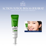 You Acne Plus Spot Care 15gr Triple Action Spot Treatment for Sensitive Skin XX333