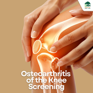 [E-Coupon] แพ็กเกจตรวจคัดกรองข้อเข่าเสื่อม (X-Ray ข้อเข่า) โรงพยาบาลบีเอ็นเอช BNH Hospital