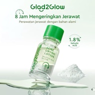Glad2Glow Acne Drying Lotion Drys Acne