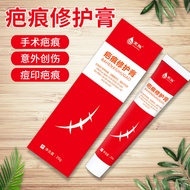 Fade Surgery Marks Caesarean Section Pregnancy Marks Scald Repair Cream Acne Marks Acne Ointment jiy