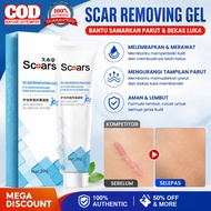 scar cream acne scar acne scar treatment scar removal 20g Proliferative scars Burn scars Keloid fadi