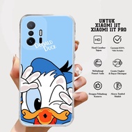 Case XIAOMI 11T/11T PRO - Latest XIAOMI 11T Case Diamons Case [MOTIF 16] Casing Hp XIAOMI 11T/11T PRO - Casing Hp - Softcase Hp XIAOMI 11T PRO - Hardcase Hp - Luxury Case - Case - Latest Case -