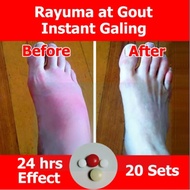 Arthritis  Rayuma  Gout Relief 20 Sets, Arthritis Medicine, Arthroneo, gloves, spray, patch, slippers, socks, gout medicine, gout cream, gout relief, gout out, gout support, goutrin, gout supporter, gout and you, gout supplement