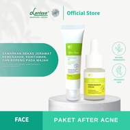 Larissa Acne Scar Package - After Acne Serum + After Acne Treatment Gel