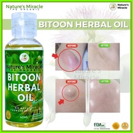 ◳  ◔  ◉ Bitoon Herbal Oil Bitoon Oil Original Bitoon Herbal Oil Original Tunaw ang Bukol Goiter Cys