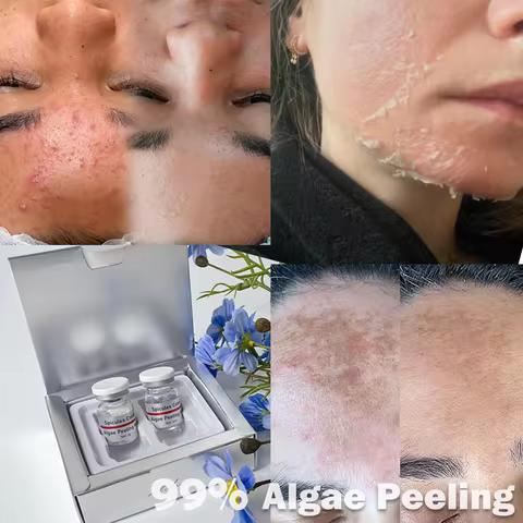 S Strongest 99% Spongilla Spicules Algae Peel Bio Spicule Peeling Melasma Freckles Stains Removal An