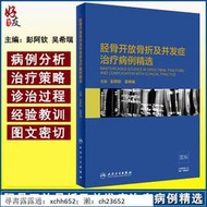 正版 現貨速發 脛骨開放骨折及並發癥治療病例精選 醫學書籍