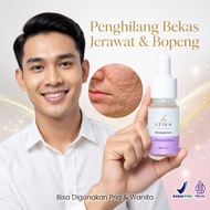Effective Permanent acne Scar Remover for Men Bpom Most Effective Removes acne Scars acne and acne S
