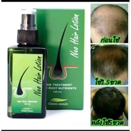 NEO HAIR LOTION SPRAY 100% from Thailandand+Derma roller